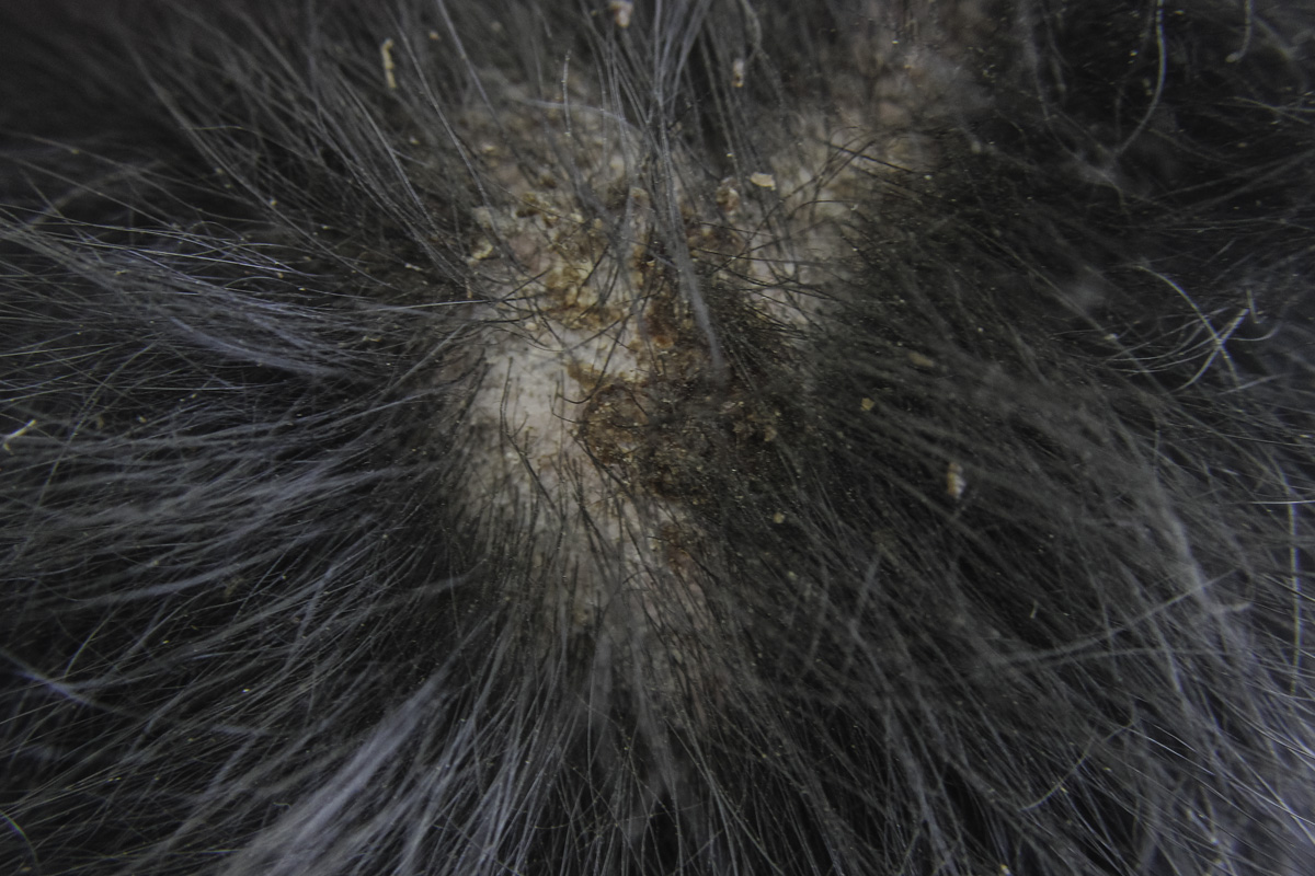 canine flea allergy dermatitis